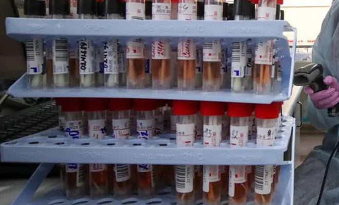 Türkiye'de son 24 saatte 58 kişi Covid-19 nedeniyle öldü, 1301 hasta şifa buldu 