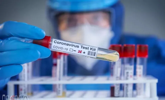 Türkiye'de son 24 saatte 2013 kişiye Covid-19 tanısı kondu 