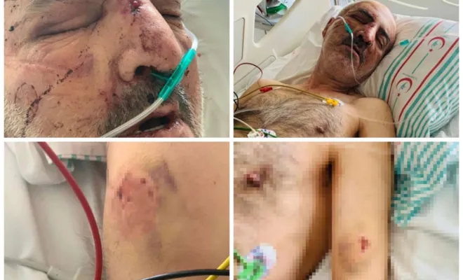 Elâzığ'da bakım merkezinde engelli vatandaşın darp edildi 